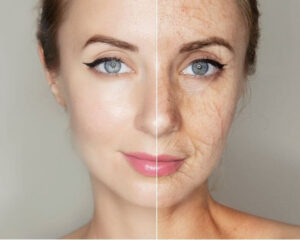 menopause skin issue